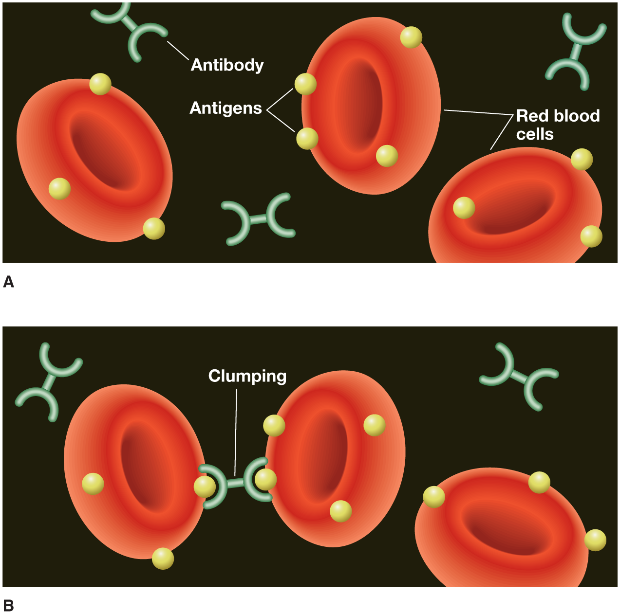Two illustrations A and B show red blood cells, antibodies and antigens. Illustration A shows antigens attached to red blood cells. Illustration B shows an antibody clumping two antigens, one each from a red blood cell.