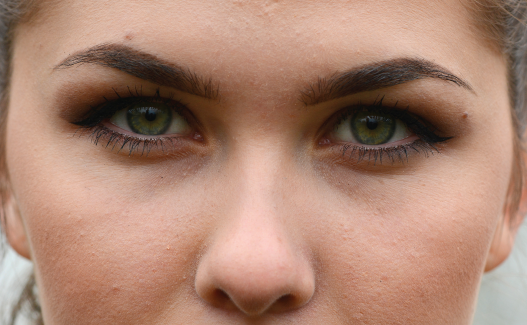 The recessive trait is no freckles.