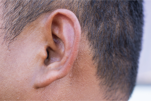 The recessive trait is attached earlobes.