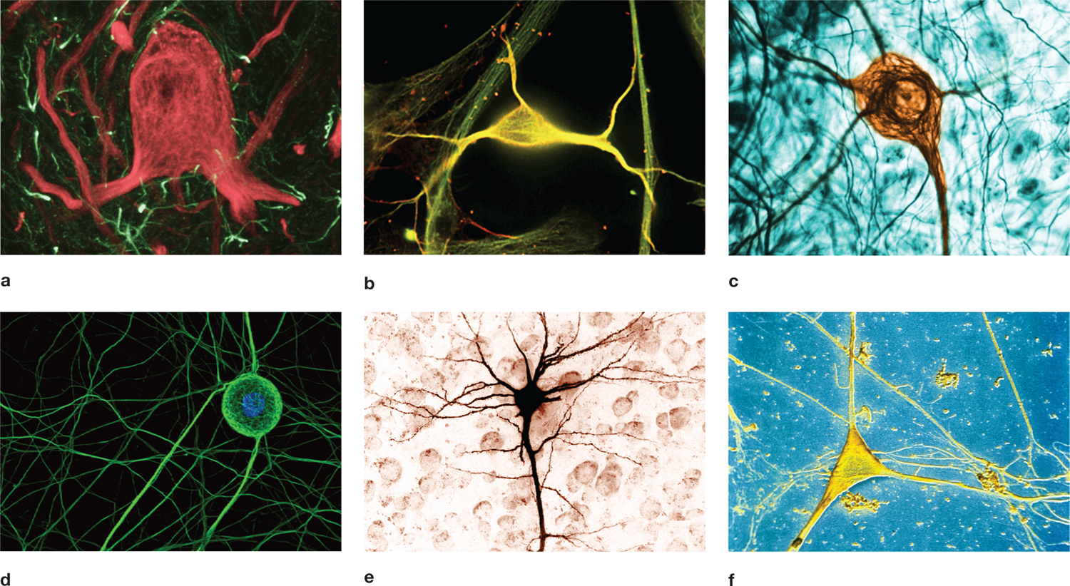 Illustration shows a mammalian neuron from the vestibular area of the brain branching out and surrounded by Gilian cells. | An illustration shows a hippocampal neuron branching out and surrounded by Gilial cells at left. The dendrits are thin and appear at the left and right ends. | Illustration of a neuron in mouse dorsal root ganglion of the spinal cord shows it having 5 branches in a star shaped fashion. It is surrounded by other branches. | Illustration shows a neuron in cell structure from dorsal root ganglia of an embryonic rat having a circular structure from which 3 main branches emanate. It has a background of many similar branches. | Illustration of a pyramidal neuron from the brain shows a central cell with a single thick branch flowing downard and few thick branches flowing outward at the top. | Illustration of a multipolar neural cell body from human cerebral cortex shows a triangular section with three branches emanating from the ends. A branch is connected to other similar branches.