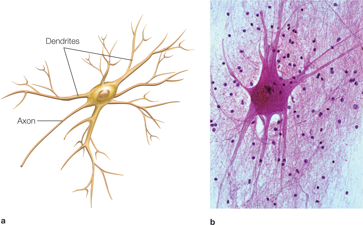 Illustration shows a spinal motor neuron with a central cell body, axon below and dendrites all over. The dendrites and axon are marked and shown. | Illustration shows a Spinal motor neuron stained with cresyl echt violet stain. It has a central cell body with numerous dendrites all over. Spots are also seen around.