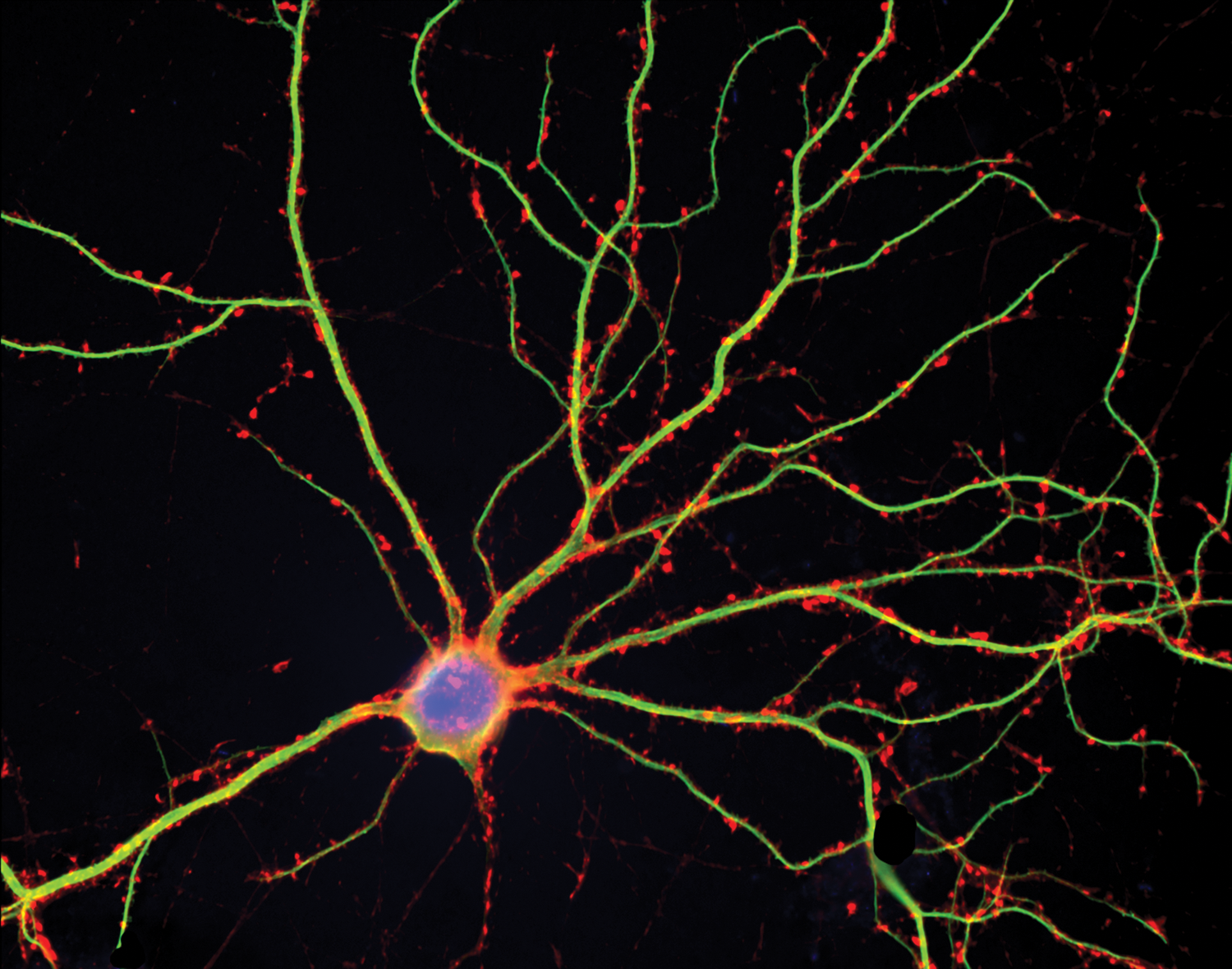 Illustration of a triple stained neuron shows a central cell, dendrites, and spines (spots on the dendrites) glowing in different shades.