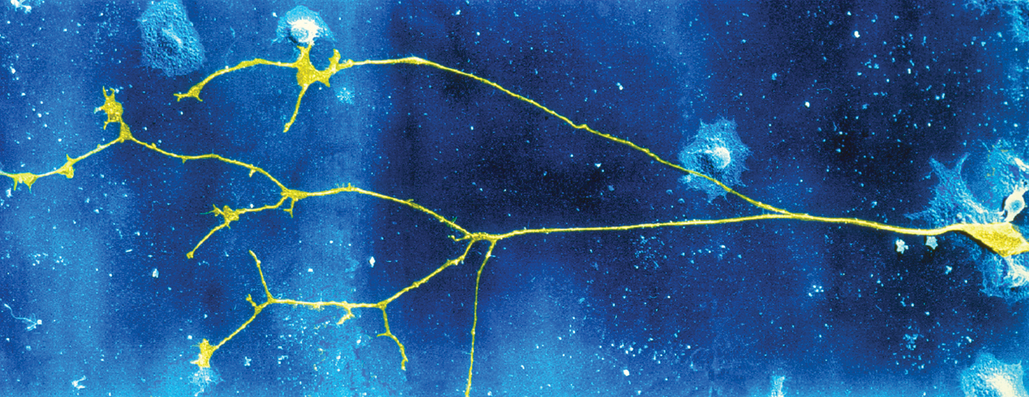 Illustration shows a neuron at far right and axon collaterals at left stained. Axons branch into collaterals.