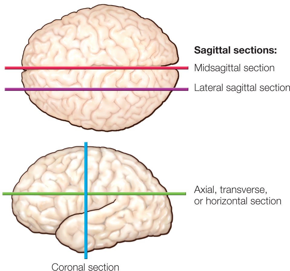 A top view of the brain lists the sagittal sections: Midsagittal section at the middle and Lateral sagittal section at left. The sideview shows the Coronal section at left from top to bottom and the axial, transverse or horizontal section running from left to right.
