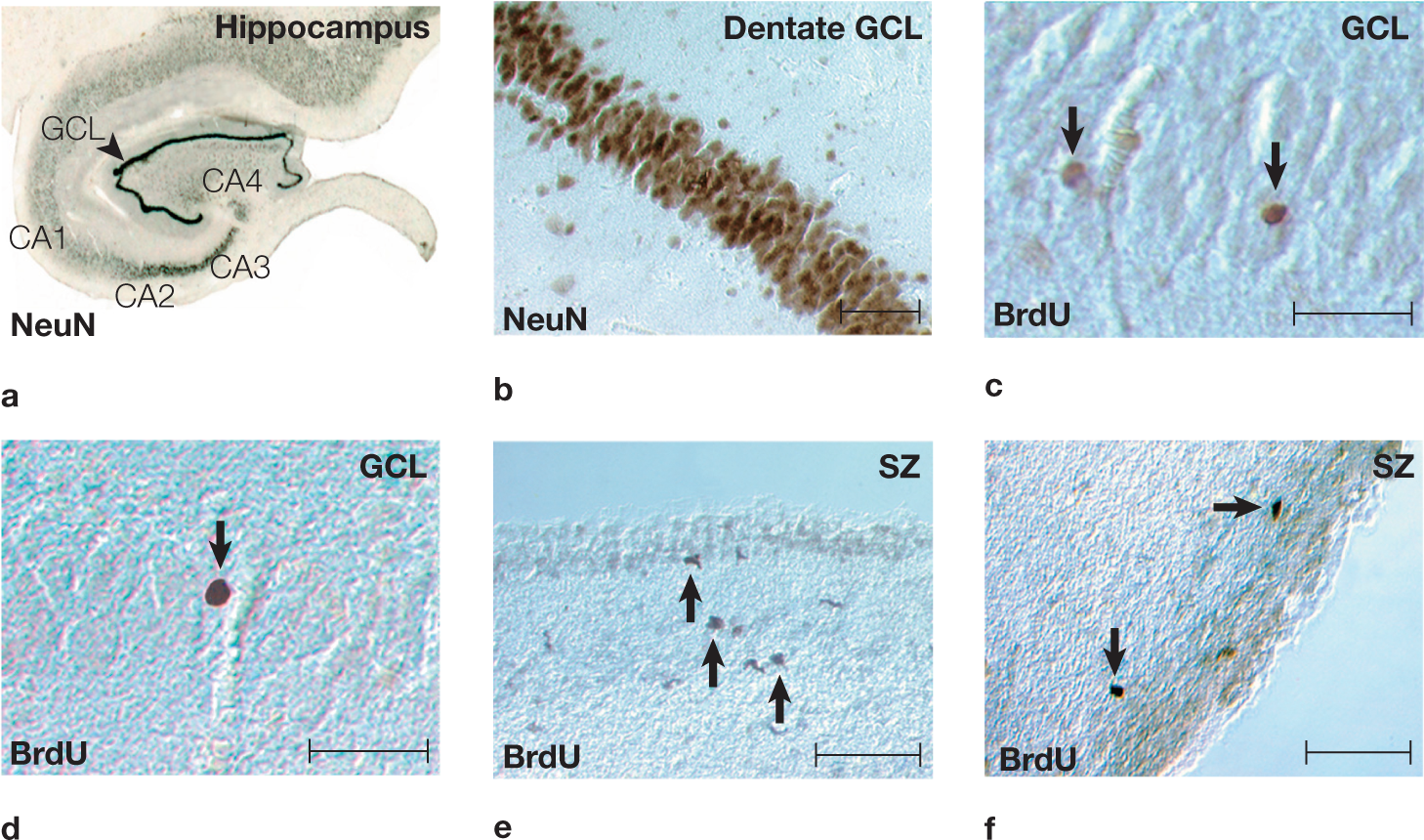 Illustrations are: ((a) The hippocampus of the adult human brain, stained for a neuronal marker (NeuN). (b) The dentate gyrus granule cell layer (GCL) in a NeuN-stained section. (c) BrdU-labeled nuclei (arrows) in the granule cell layer of the dentate gyrus. (d) BrdU-labeled cells (arrow) in the granule cell layer of the dentate gyrus. (e) BrdU-stained cells (arrows) adjacent to the ependymal lining in the subventricular zone (SZ) of the human caudate nucleus. These neurons have elongated nuclei resembling the migrating cells that typically are found in the rat subventricular zone. (f) BrdU-stained cells (arrows) with round to elongated nuclei in the subventricular zone of the human caudate nucleus. Scale bars throughout = 50 ?m.