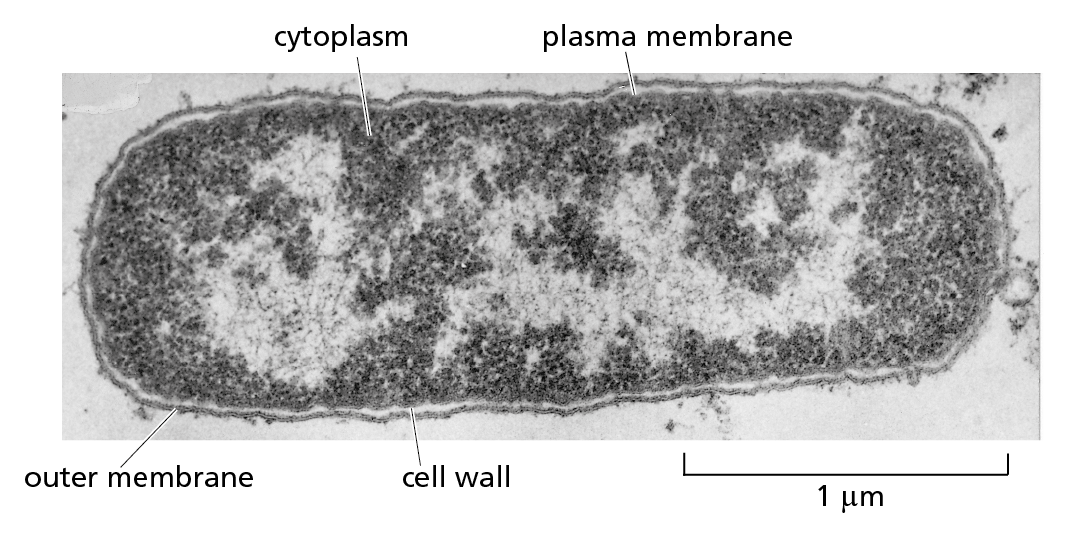A micrograph shows a longitudinal section of an Escherichia coli bacterium.