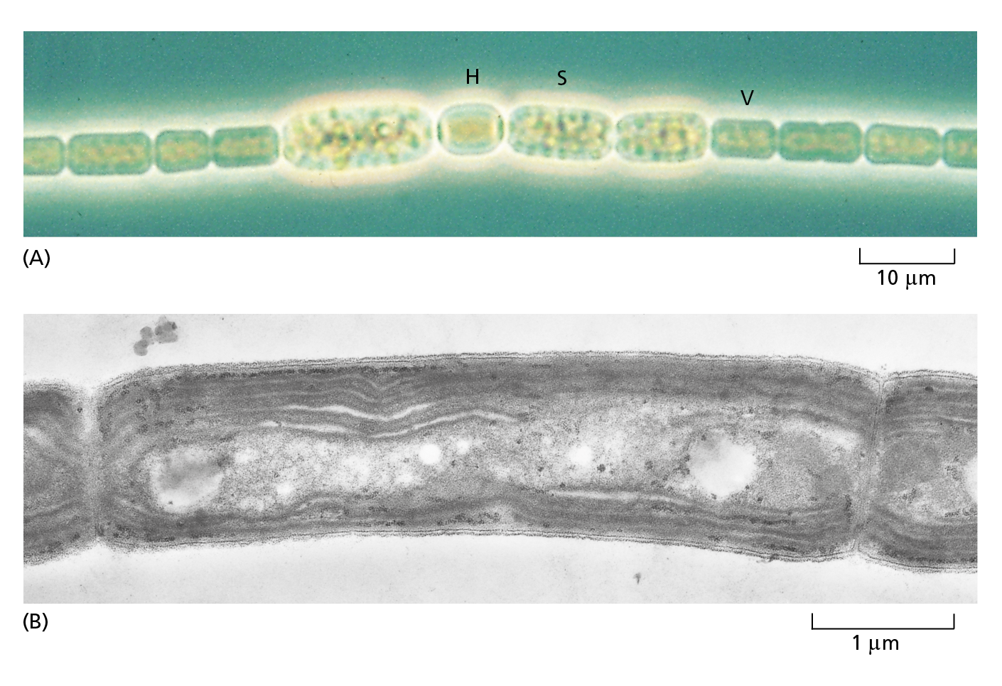Micrographs A and B show cross sections of the bacteria Anabaena cylindrica and Phormidium laminosum, respectively.