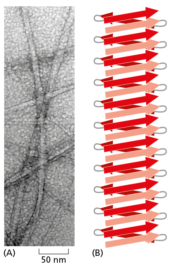 A diagram shows an electron micrograph of amyloid’s β sheet structure next to a ribbon model of β sheets.
