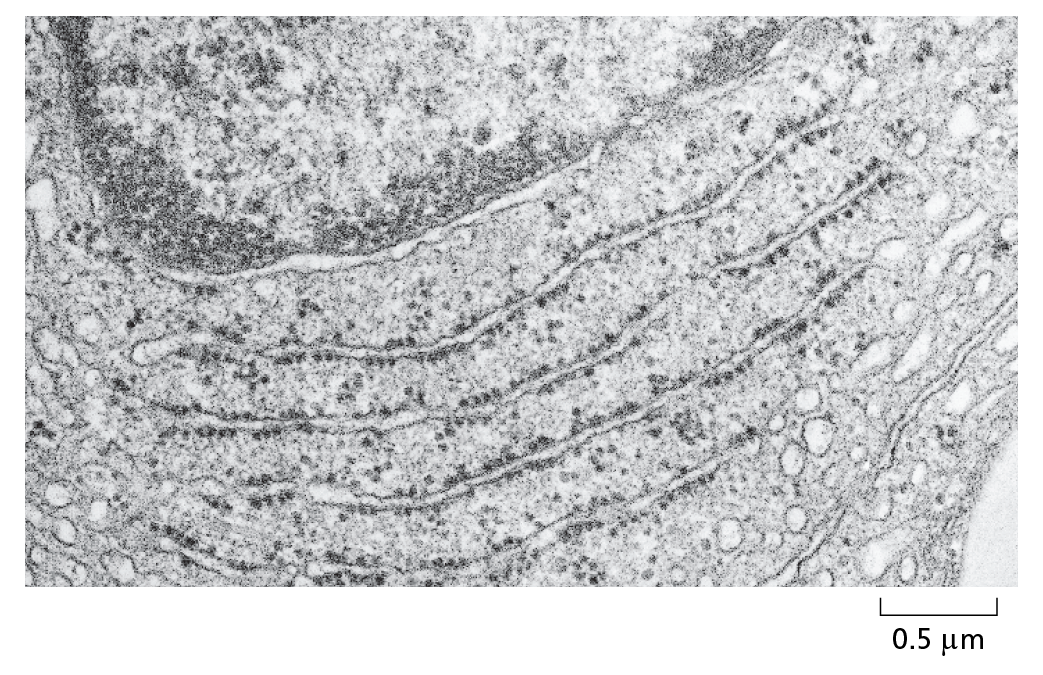  Transmission Electron Microscopy