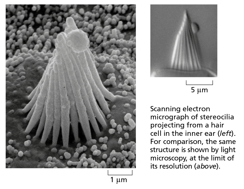 Scanning Electron Microscopy