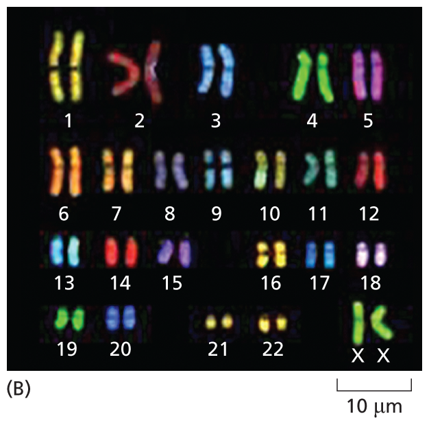 A fluorescent micrograph of organized chromosomes is shown.