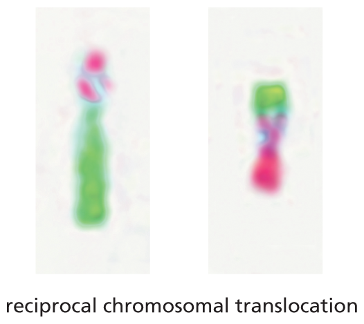 An illustration shows two abnormal chromosomes formed through reciprocal chromosomal translocation.