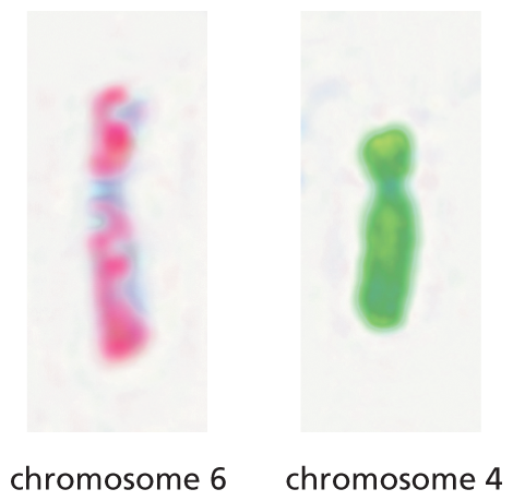 An illustration shows two normal chromosomes: chromosomes 6 and 4.