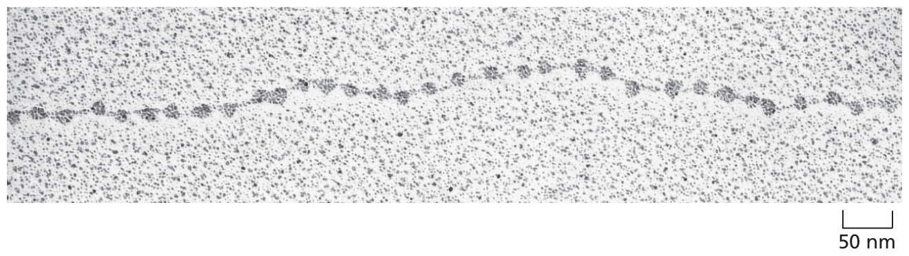 A micrograph shows decondensed nucleosomes.