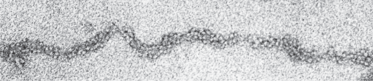 A micrograph shows packed nucleosomes.