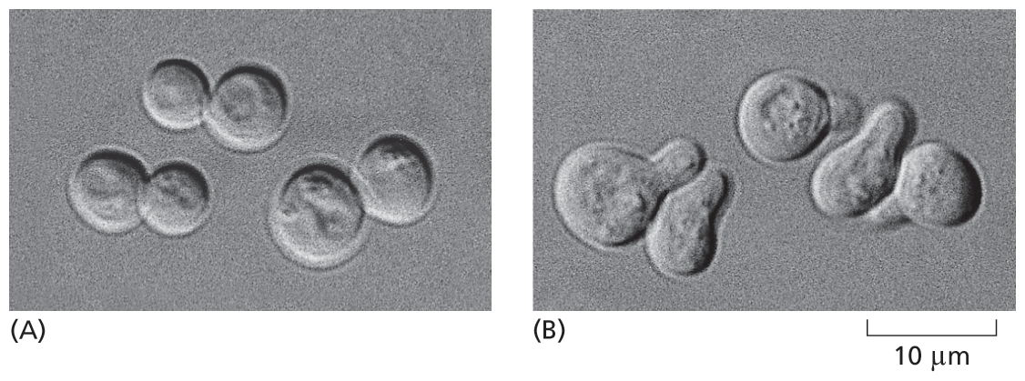 Two micrographs of yeast cells.