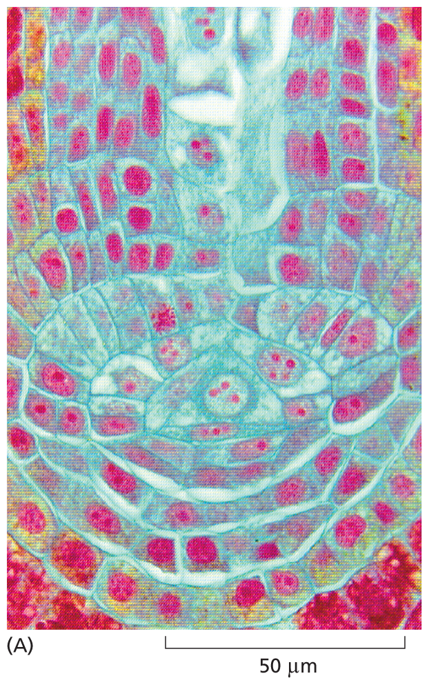 A micrograph shows fern cells, approximately 10 micrometers in diameter.