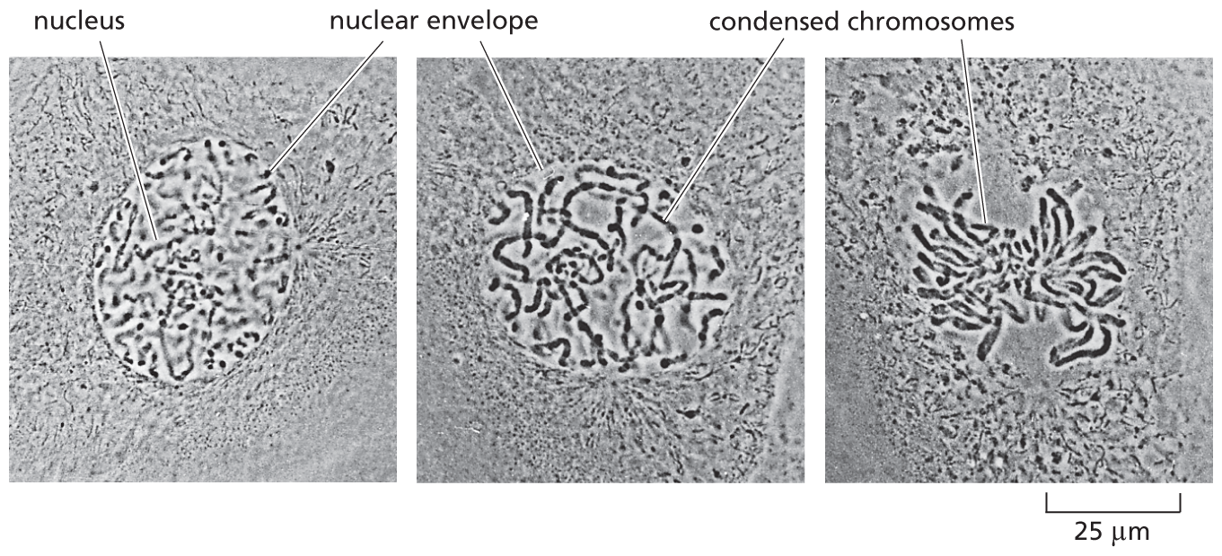 Three micrographs depict the condensation of chromosomes during cell division.