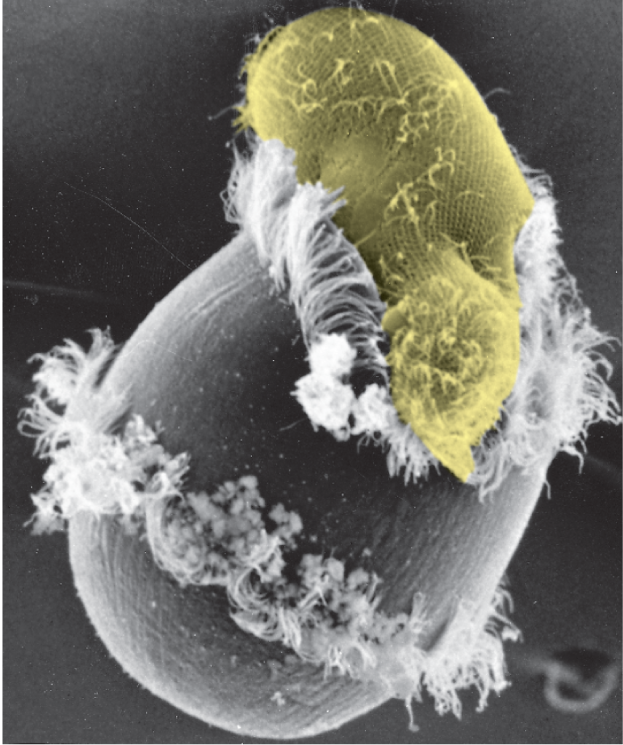 A micrograph shows a Didinium ingesting another protozoan, a Paramecium.