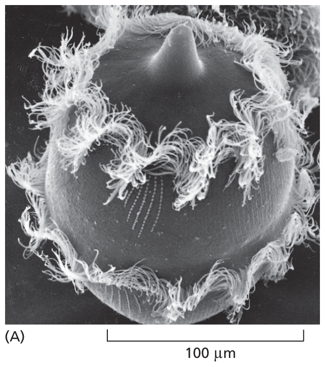 A micrograph shows a Didinium.