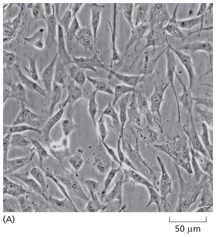 A micrograph shows spindle shaped cells from human skin.