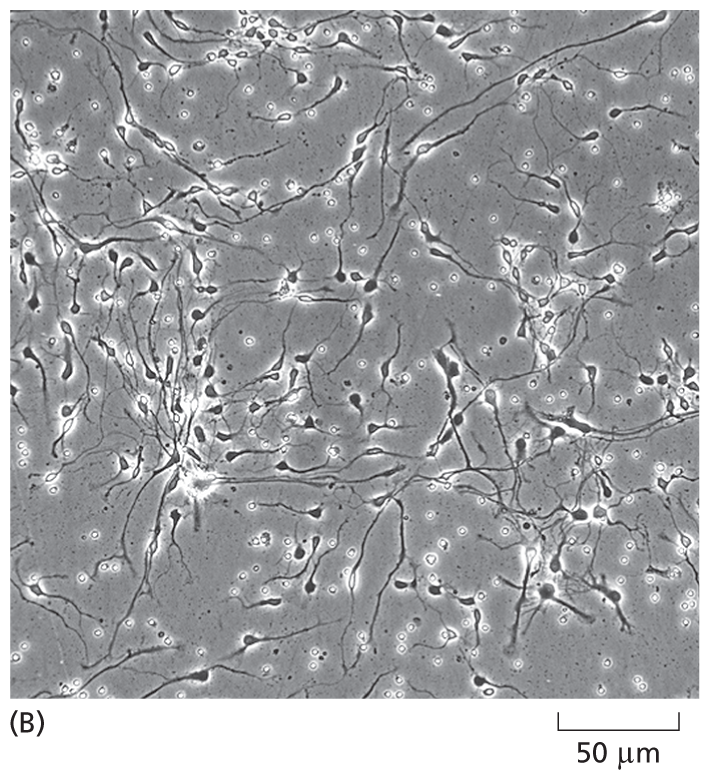 A micrograph shows interconnected human neurons on a scale of 50 micrometers.