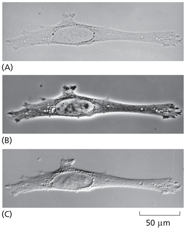 Three micrographs show unstained samples.