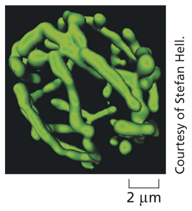 A micrograph shows a three dimensional view of a branched mitochondrion.