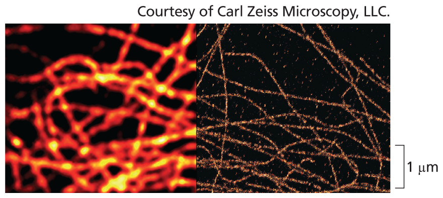 Two micrographs of microtubules one using a conventional fluorescence microscope and the other with a super-resolution optics