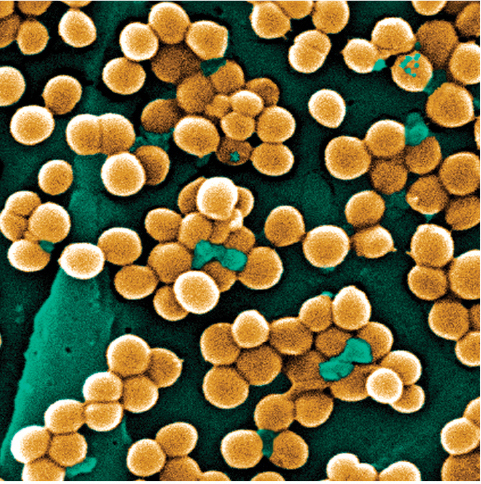 Staphylococcus aureus. The cells are roughly clustered into groups of about 10 cells. Each cell is shaped like a circle.