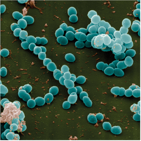 Enterococcus faecalis. The spherical cells are gathered into string-like clusters.