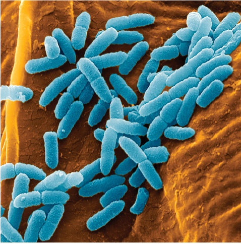 Pseudomonas aeruginosa. The cells are rod-shaped.