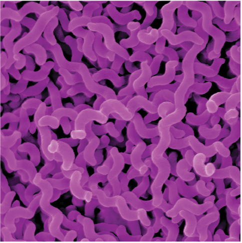 Campylobacter jejuni. The cells in the cluster are corkscrew-shaped.