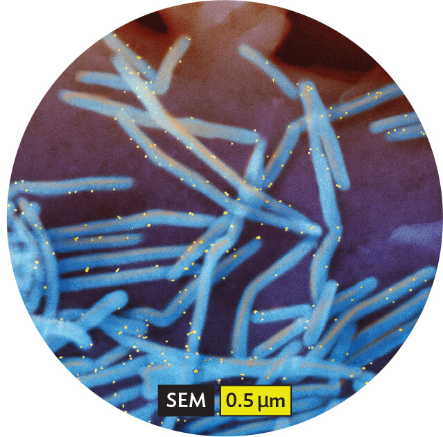 A scanning electron micrograph of respiratory syncytial virus, abbreviated R S V, particles.