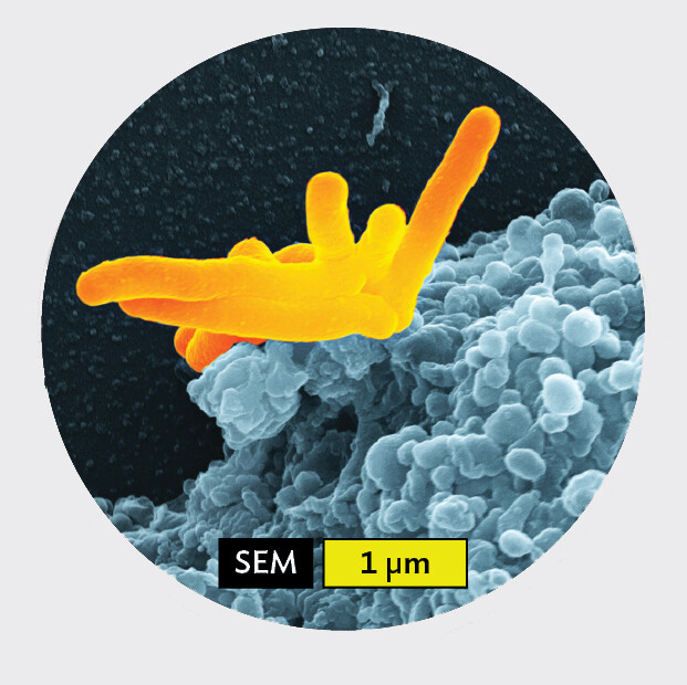A scanning electron micrograph of Mycobacterium tuberculosis being engulfed by a human macrophage.