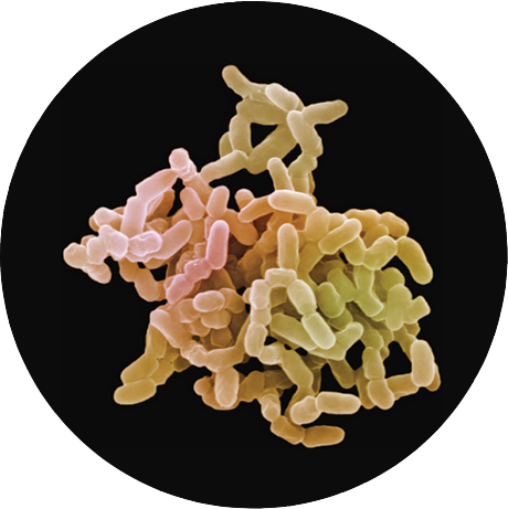 A scanning electron micrograph of Mycobacterium tuberculosis cells.