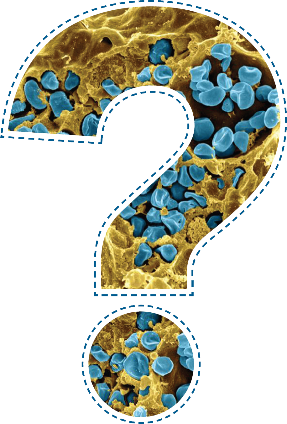 An illustrated outline of a question mark overlaid on a scanning electron micrograph of Francisella tularensis.