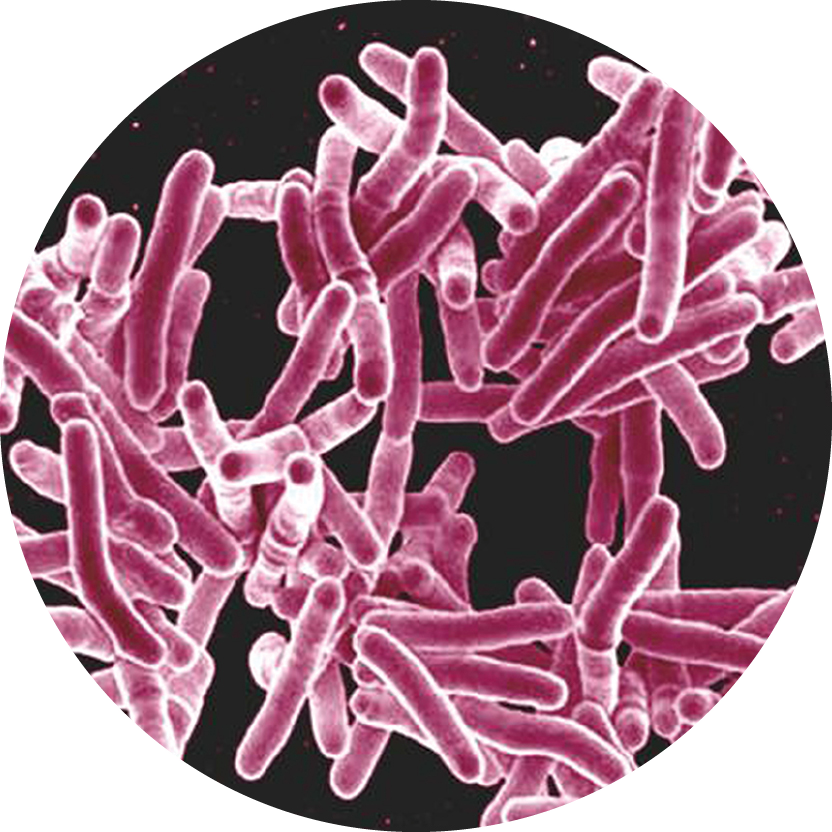 A micrograph of M. tuberculosis.