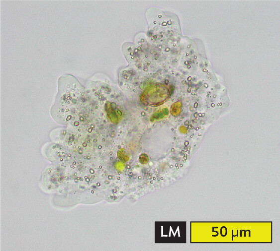 A light micrograph of Pelomyxa species, which is a large ameba with complex internal cell organelles.