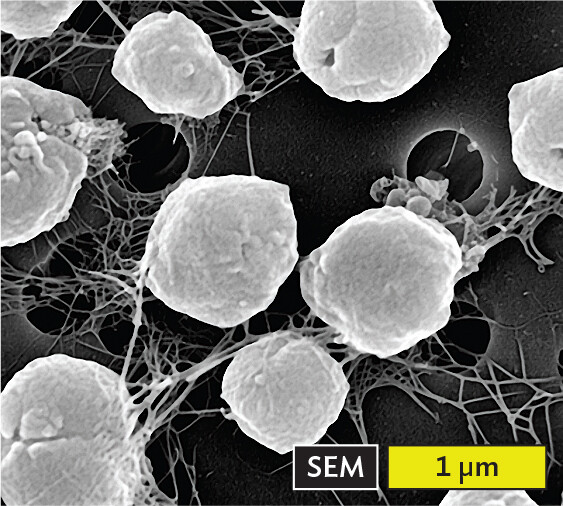 A scanning electron micrograph of the archaeon Methanocaldococcus jannaschii.