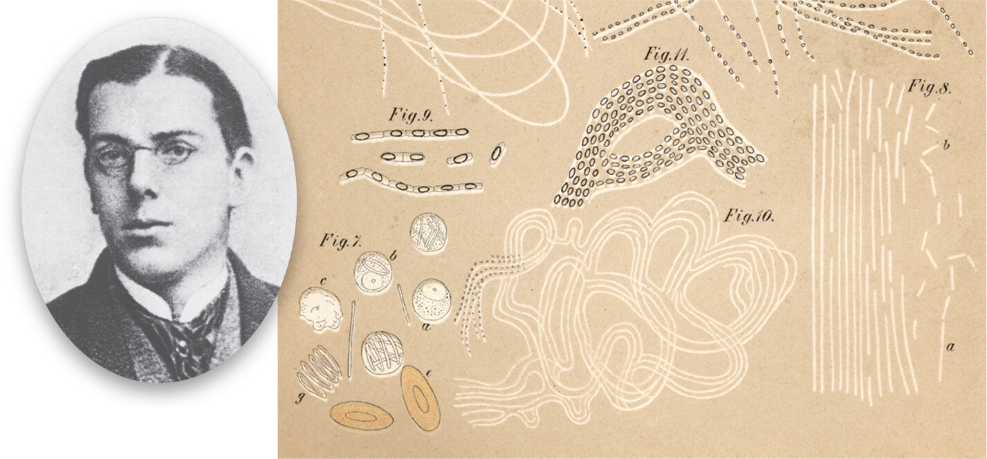 A photo of Robert Koch as a university student.; An illustration of anthrax bacilli in mouse blood by Robert Koch.