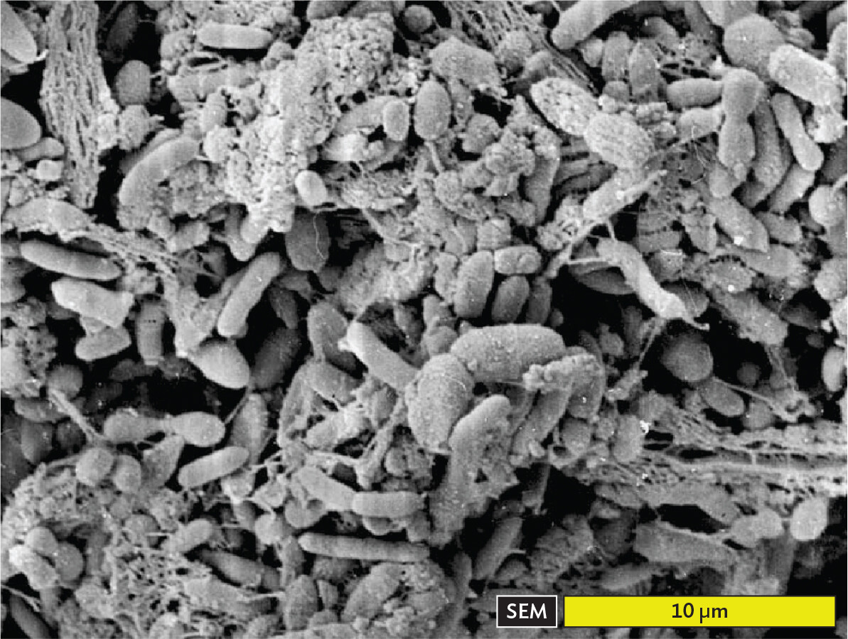 A scanning electron micrograph of a biofilm with various digestive bacteria in the human intestine.