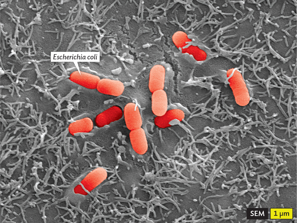 A scanning electron micrograph of Escherichia coli cells adhering to human cells.