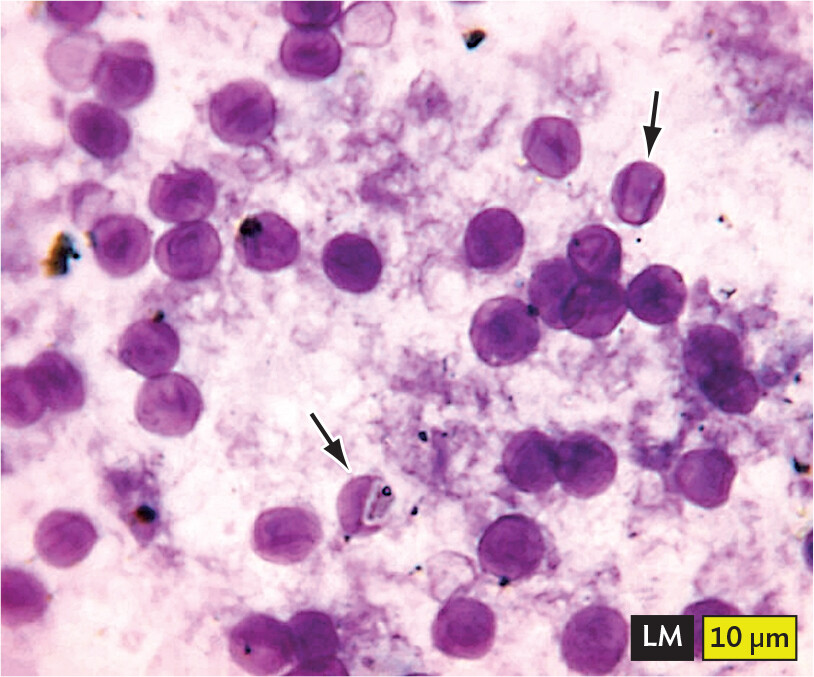 A light micrograph of Pneumocystis jirovecii cysts.