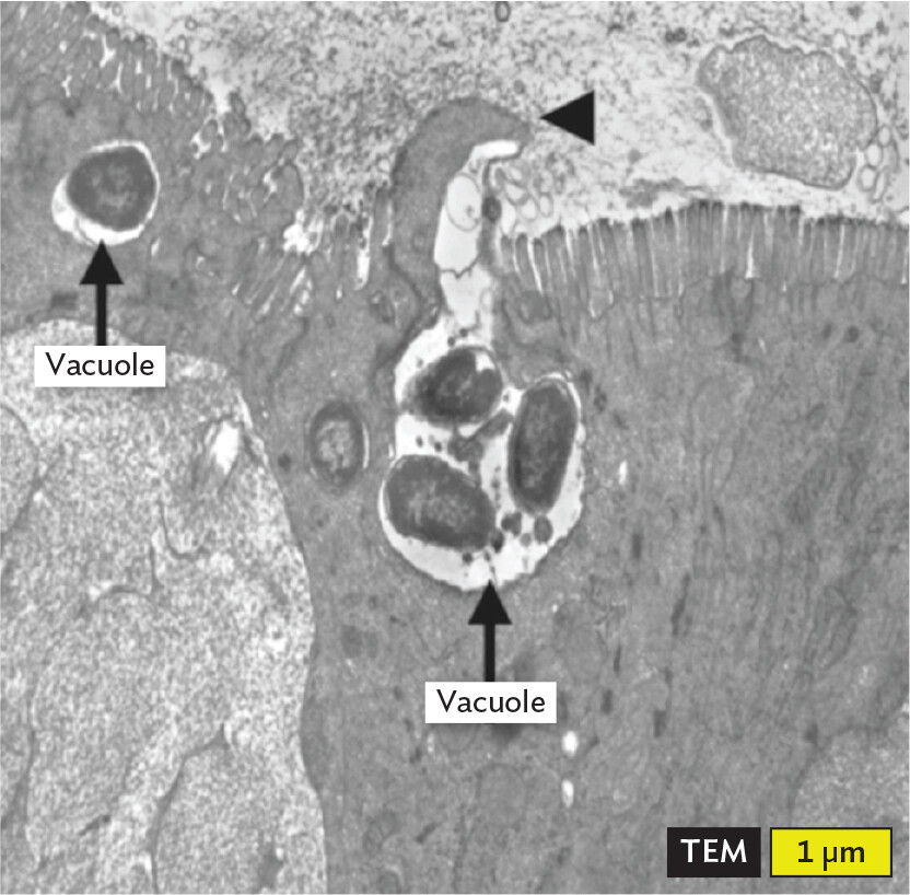 A transmission electron micrograph of Salmonella enterica bacterial cells invading intestinal cells.