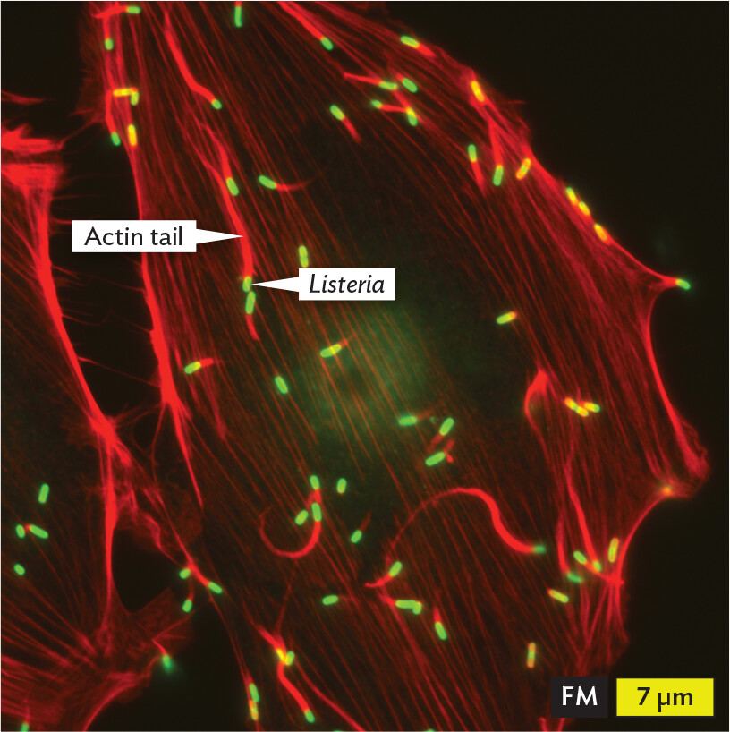 A fluorescence micrograph of Listeria bacterial cells invading eukaryotic host cells.