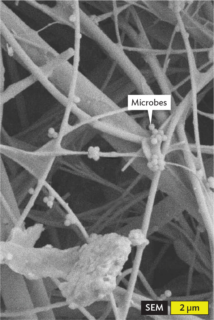 A scanning electron micrograph of microbes trapped in an H E P A filter.