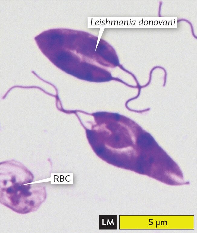 A light micrograph of the parasite Leishmania donovani.