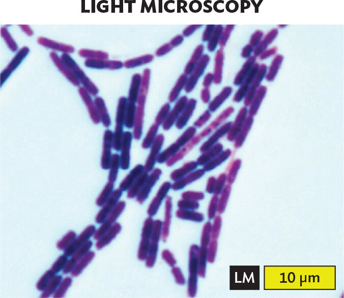 A light micrograph of Bacillus species, an example of filamentous rods or bacilli.