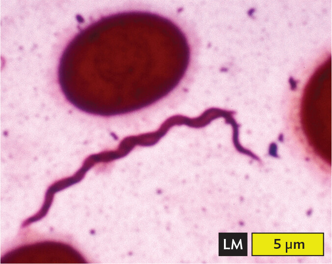 A light micrograph of Borrelia burgdorferi, an example of a spirochete.